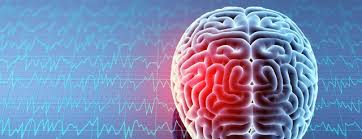 concussion brain injury